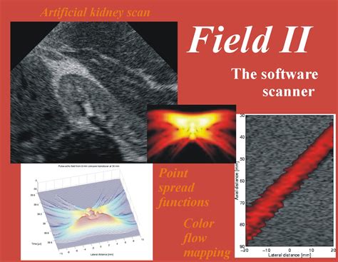 advanced ultrasound systems|Simulation of advanced ultrasound systems using Field II .